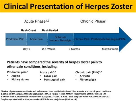 hermes zoster è contagiosa p|Epidemiology, clinical manifestations, and diagnosis of herpes .